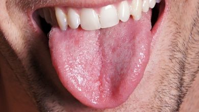 How To Lose Tongue Fat Exercise